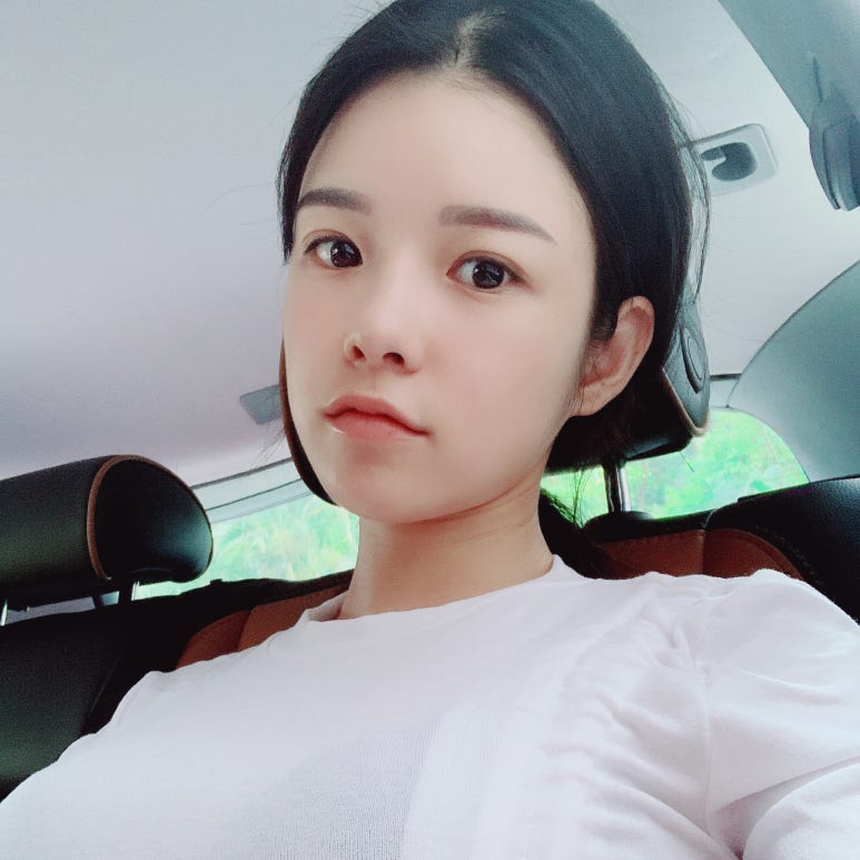 쌍꺼풀수술비용 충분히 고민해 보고 관련 이미지 4