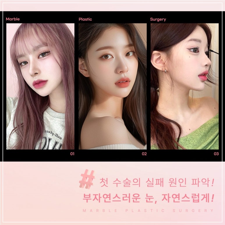 쌍수 눈재수술잘하는곳의 쌍꺼풀재수술 : 안전성, 심미적 측면, 비용 가격 등 관련 이미지 4