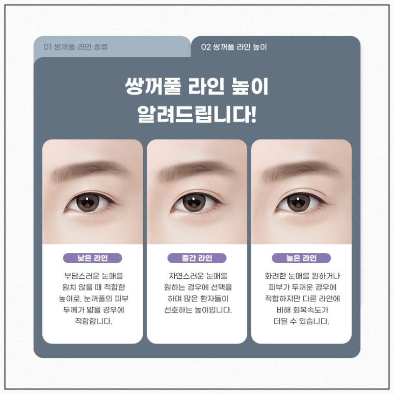 쌍꺼풀수술잘하는곳, 자연유착 잘하는 병원 관련 이미지 7