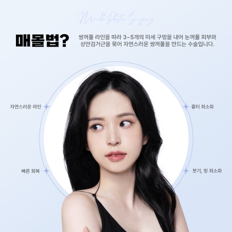 눈성형 매몰법으로 자연스럽고 조화로운 눈매 관련 이미지 2