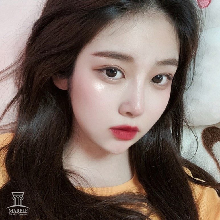 얼굴주름리프팅 나에게 맞는 리프팅 방법으로! 마블성형외과의원 관련 이미지 10