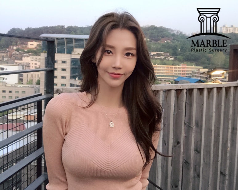 쌍꺼풀수술 후 관리 마블성형외과의원에서 정보 얻기! 관련 이미지 6