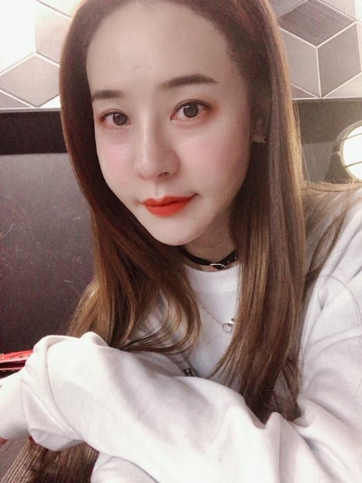처진얼굴리프팅 효과적 개선 방법은! 마블성형외과의원 관련 이미지 9