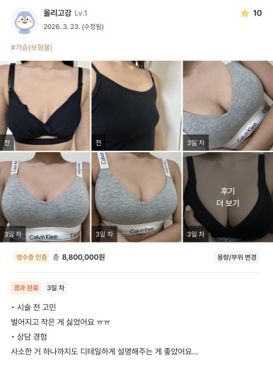 [마블성형외과 가슴성형 후기] 재수술이라 정말 무서웠는데, 원장님 확신 한마디에 믿고 맡기길 정말 잘했어요! 관련 이미지 1