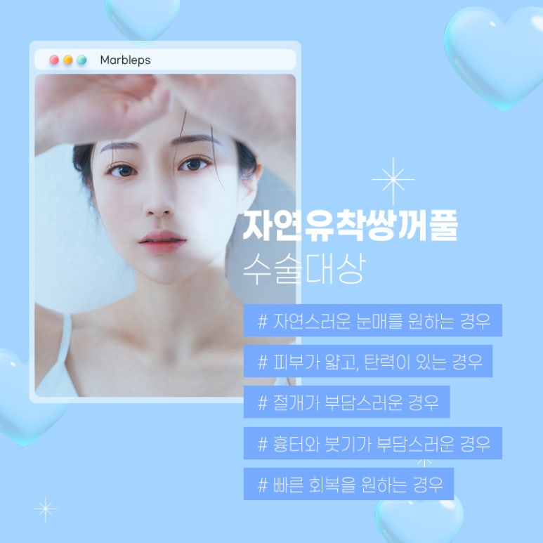 자연유착후기 기대와 현실적인 결과 관련 이미지 5
