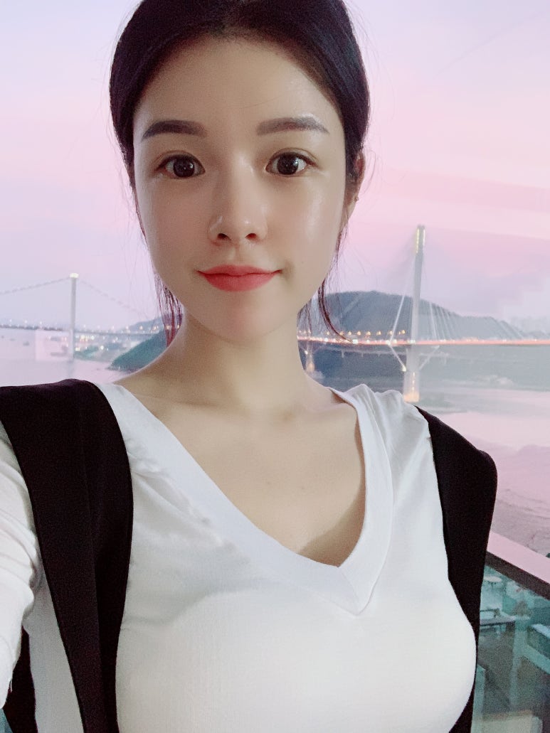 짝눈쌍꺼풀수술 섬세하게 라인을 맞춰서 관련 이미지 7