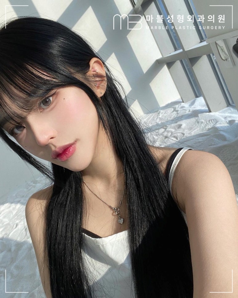 얼굴지방흡입비용 & 효과 궁금하다면? 마블성형외과의원 관련 이미지 9
