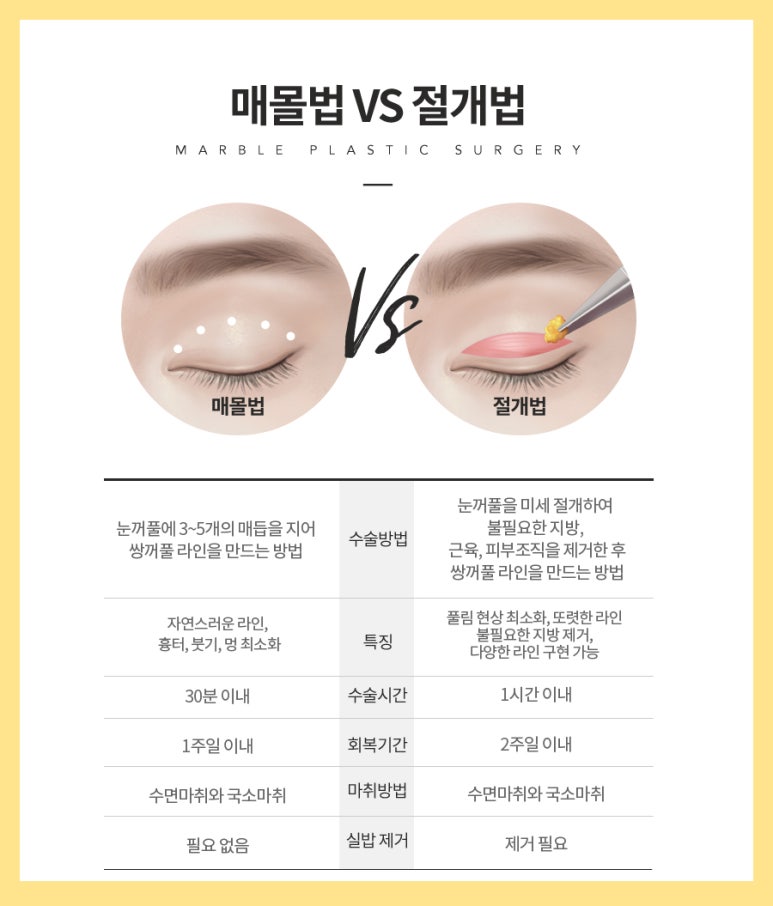 쌍꺼풀수술가격 함께 알아봐요! 관련 이미지 2