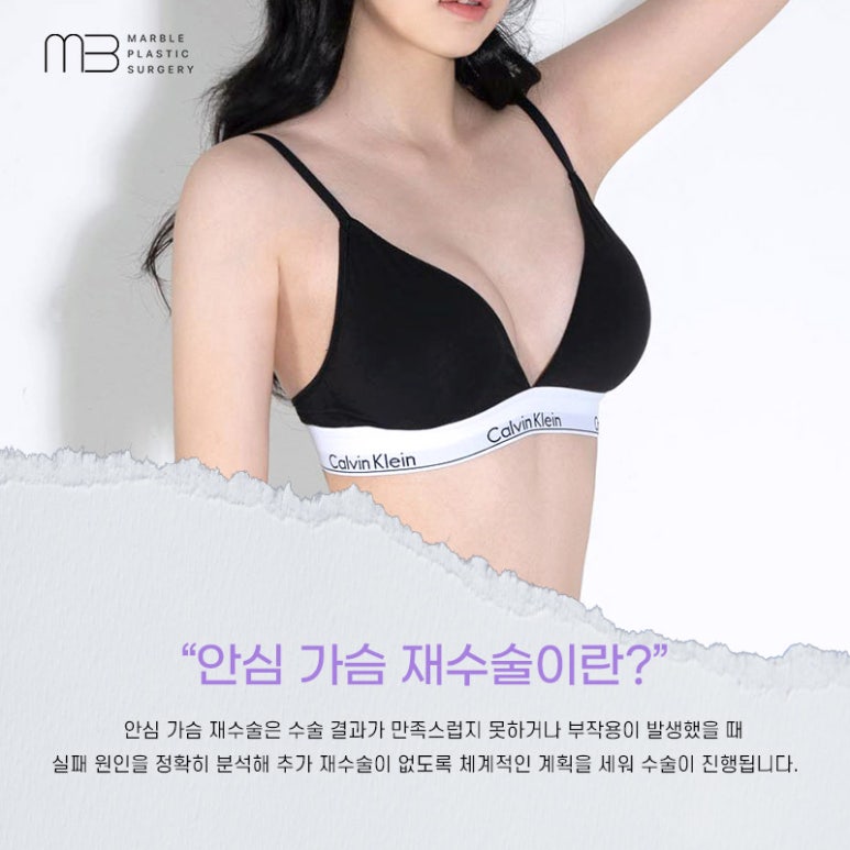 가슴성형 재수술, 언제 하는 것이 가장 적절할까? 관련 이미지 2