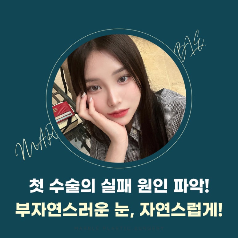 쌍꺼풀재수술 새로운 시작을 위한 가이드 관련 이미지 4