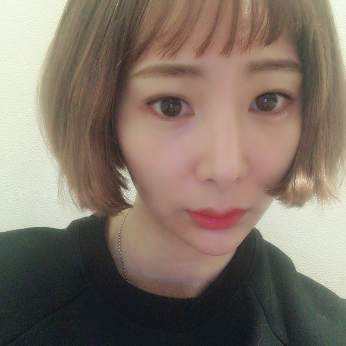 내시경이마거상술 확실한 이마주름제거 가능할까? 마블성형외과의원 관련 이미지 2