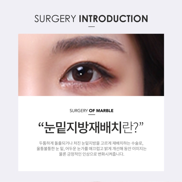 눈밑지방재배치 칙칙한 인상은 그만! 관련 이미지 3