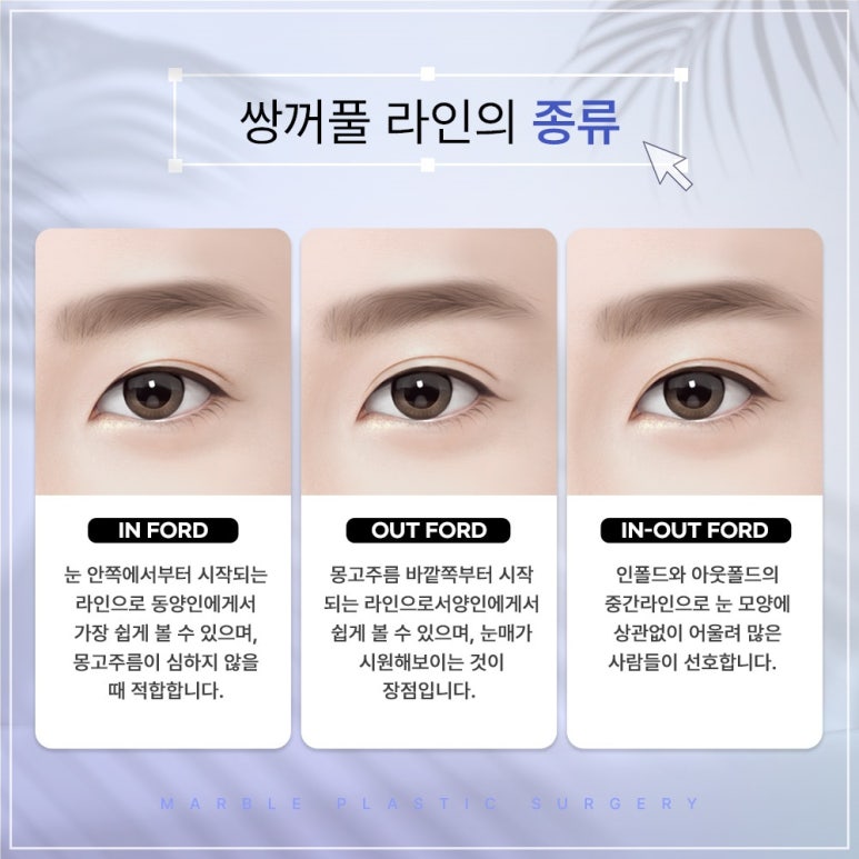 쌍꺼풀수술잘하는곳과 수험생을 위한 수험생이벤트 관련 이미지 4