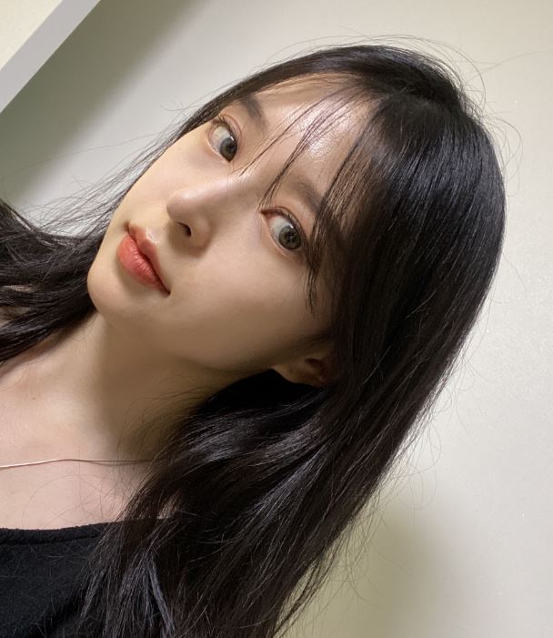절개쌍꺼풀 비절개쌍꺼풀 차이점과 눈성형 상식 Q&A 관련 이미지 8