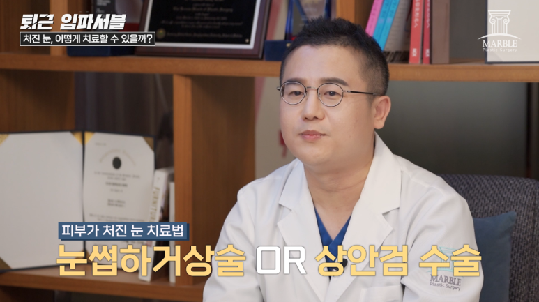 눈매교정수술 눈처짐 개선할 수 있을까? 관련 이미지 11