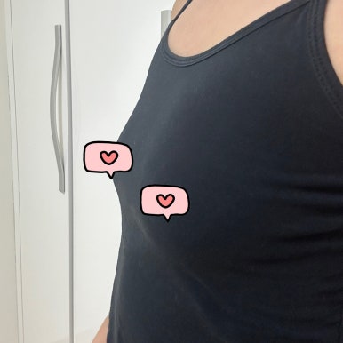 [강남성형외과 가슴확대수술 후기] 벌어진 작은 가슴이 늘 고민이었는데..자연스러운 I자 가슴골로 대만족! 관련 이미지 2