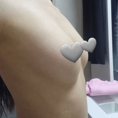[강남역 성형외과 가슴수술 후기] 지방이식으로도 불만족이었는데,, 서일범 원장님표 라인으로 인생 핏 성공! 관련 이미지 5