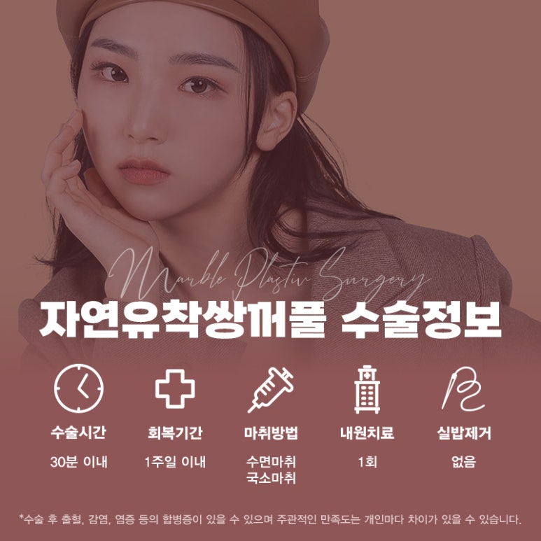 자연유착쌍꺼풀가격 보다 체크해야할 것은? 관련 이미지 3
