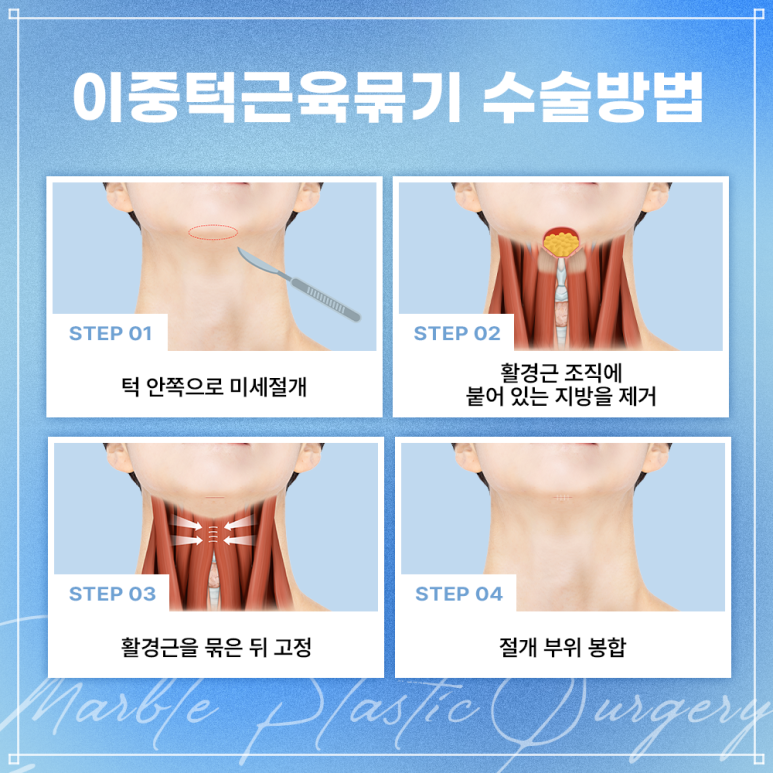 이중턱근육묶기부작용 걱정된다면? 꼭 알아야 할 포인트 정리｜마블성형외과 관련 이미지 3
