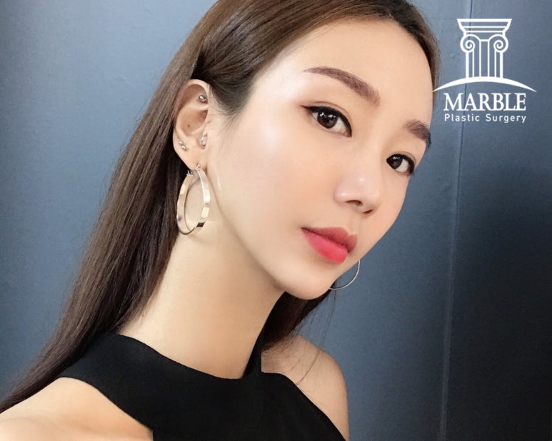 쌍꺼풀수술 후 관리 마블성형외과의원에서 정보 얻기! 관련 이미지 7