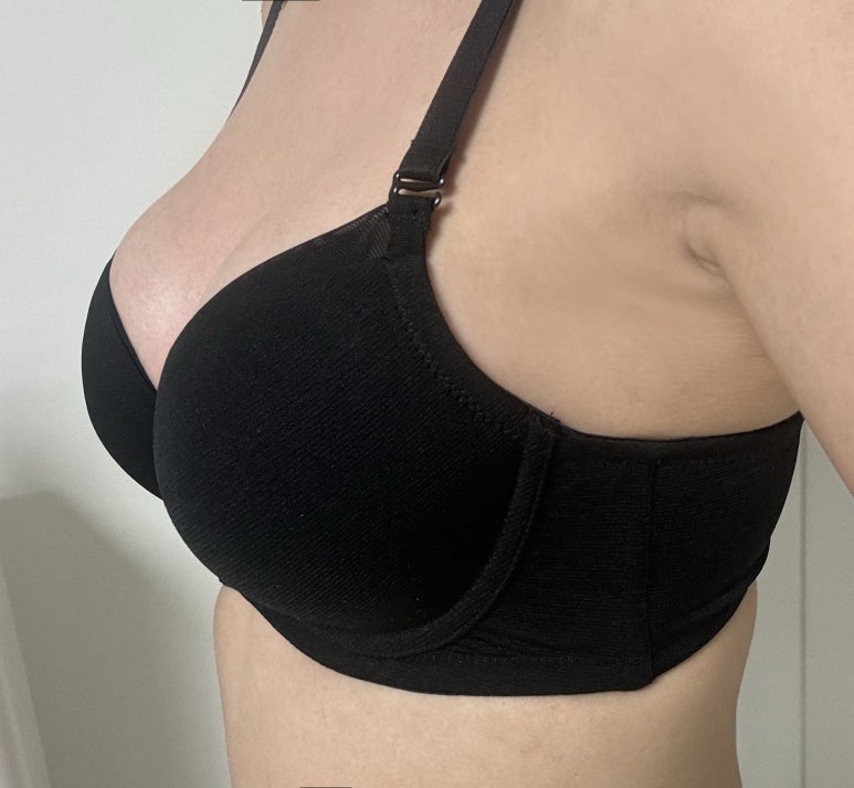 Where Should You Go for a Famous Breast Surgery Clinic Near Sinnonhyeon Station? image 6