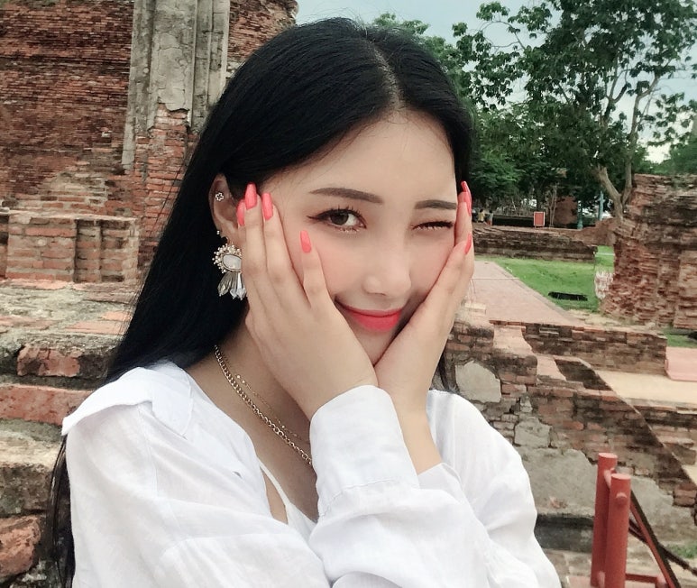 쌍수라인 실밥제거후 두갈래로 잡힌 경우 마블성형외과의원 관련 이미지 2