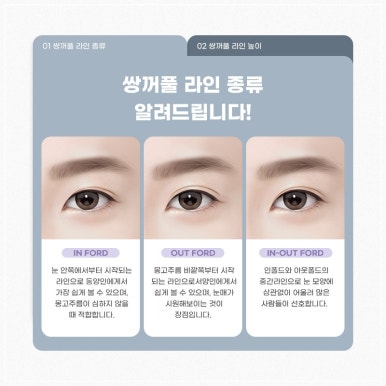 고등학생성형이벤트, 안전하고 현명하게 선택하는 법 관련 이미지 5