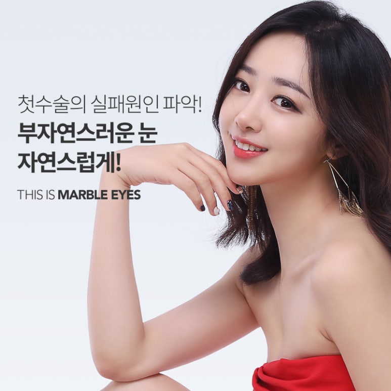 쌍꺼풀재수술 알아보고 반복하지말자 관련 이미지 5