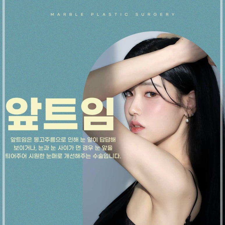눈트임성형, 답답한 눈에서 시원한 눈매로 관련 이미지 1