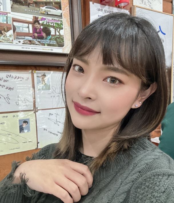 쌍수잘하는곳 수술 전 입문 포인트! 관련 이미지 5