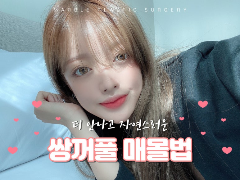 쌍수매몰법 섬세한 디테일로 자연스럽게! 관련 이미지 1