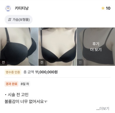 [Gangnam Plastic Surgery Breast Augmentation Real Review] I Was Tired of Not Wanting to Wear a Bra Top—My Uneven Breasts Are Finally Corrected, and I’m So Satisfied with the Upper Volume Lineㅎㅎ image 1