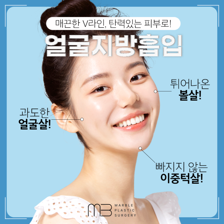 얼굴지방흡입비용 & 효과 궁금하다면? 마블성형외과의원 관련 이미지 4