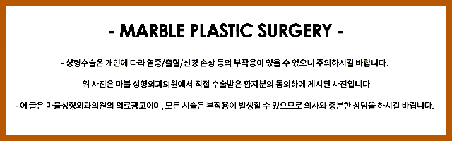 눈재수술유명한곳 결정 전에 알아야 할 정보 관련 이미지 6