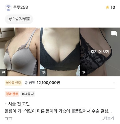 [Gangnam Plastic Surgery Breast Augmentation Review] My Longtime Concern About My Slim Upper Body... A Beautiful Shape Achieved Through Personalized Diagnosis, Haha image 1