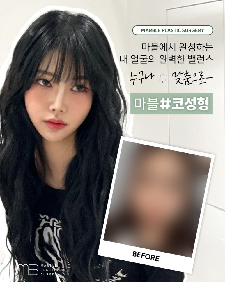 수험생 코성형, 방학동안 안전하게 준비하는 방법 관련 이미지 2