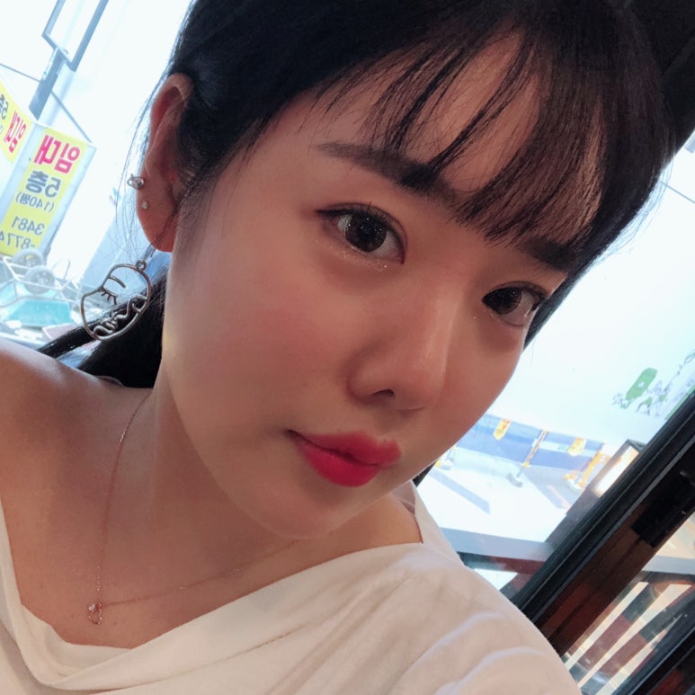 눈밑트임 부드러운 이미지로! 마블성형외과의원 관련 이미지 3
