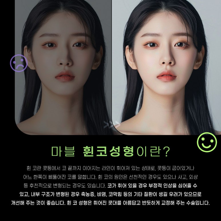 휜코수술가격부터 회복과정까지 꼼꼼하게 관련 이미지 2