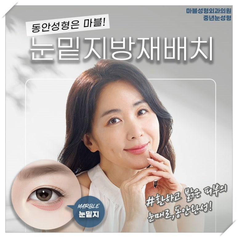 눈밑지방재배치 수술효과와 유지 기간: 정말 젊어 보일까? 관련 이미지 1