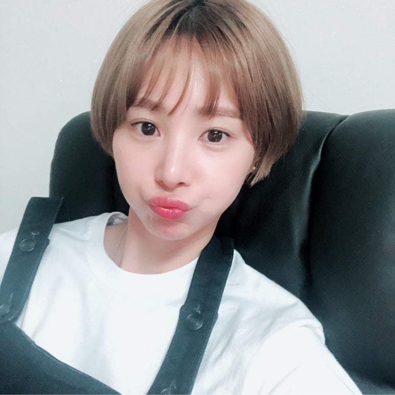 눈매교정수술 혹시 안검하수일까요?마블성형외과의원 관련 이미지 5