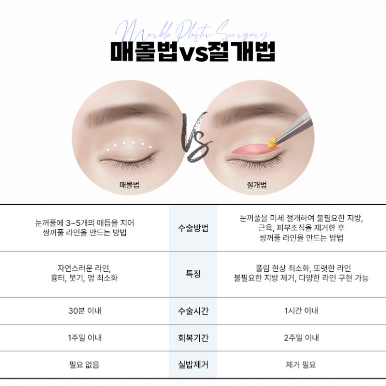 눈성형 매몰법으로 자연스럽고 조화로운 눈매 관련 이미지 6