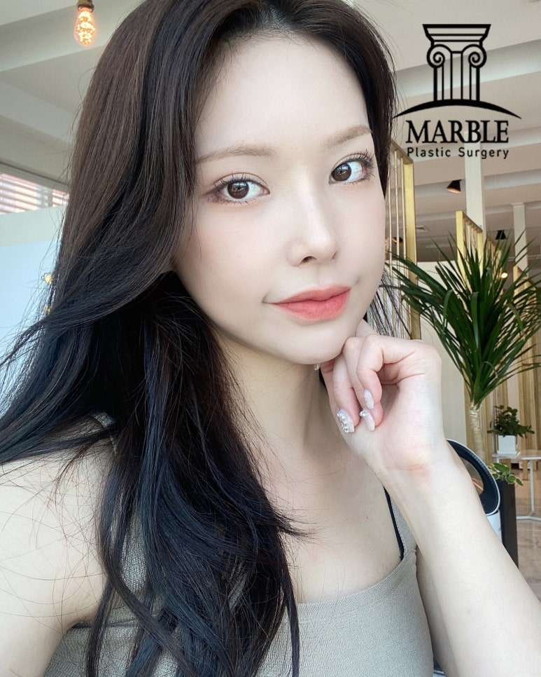 눈수술(눈성형) 후, 알아두면 좋은 주의사항 정리! 관련 이미지 6