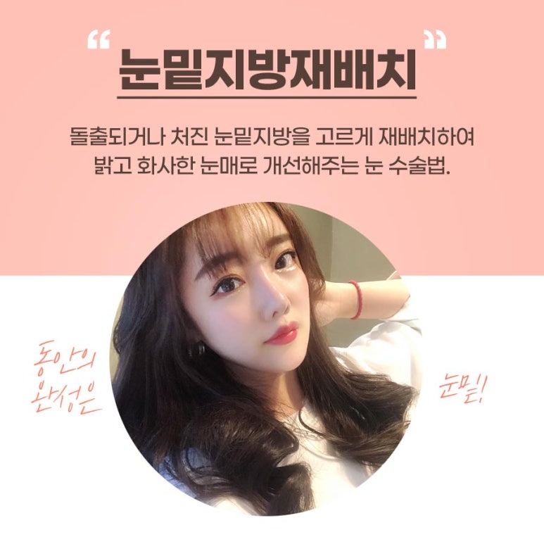 눈밑지방재배치잘하는곳 칙칙한 인상에서 벗어나 관련 이미지 3