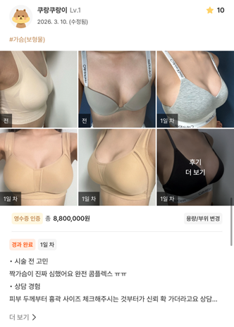 [Marvel Plastic Surgery Breast Surgery Review] My breasts were very uneven — it was a huge complex for me ㅠㅠ image 1