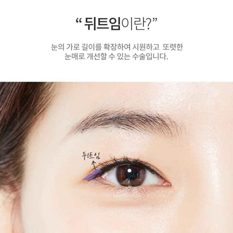 뒤트임 시원하고 또렷한 눈매로 관련 이미지 1