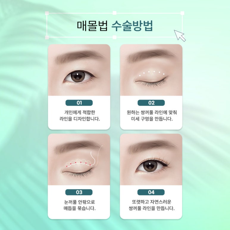 쌍수매몰 알고 싶은 모든 것 관련 이미지 5