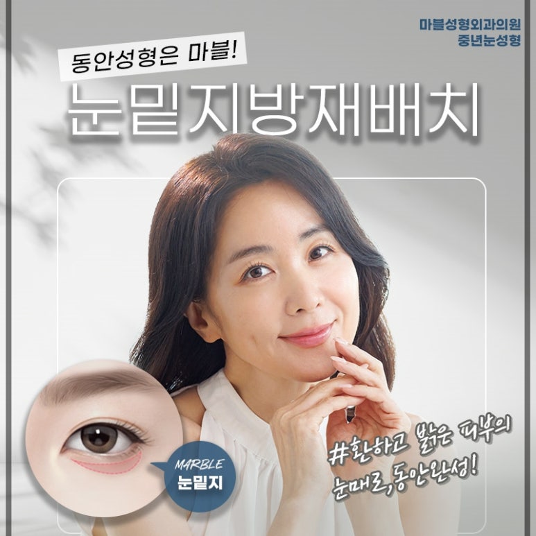 눈밑지방재배치수술비용 꼭 알아야 할 기준은?｜마블성형외과의원 관련 이미지 7