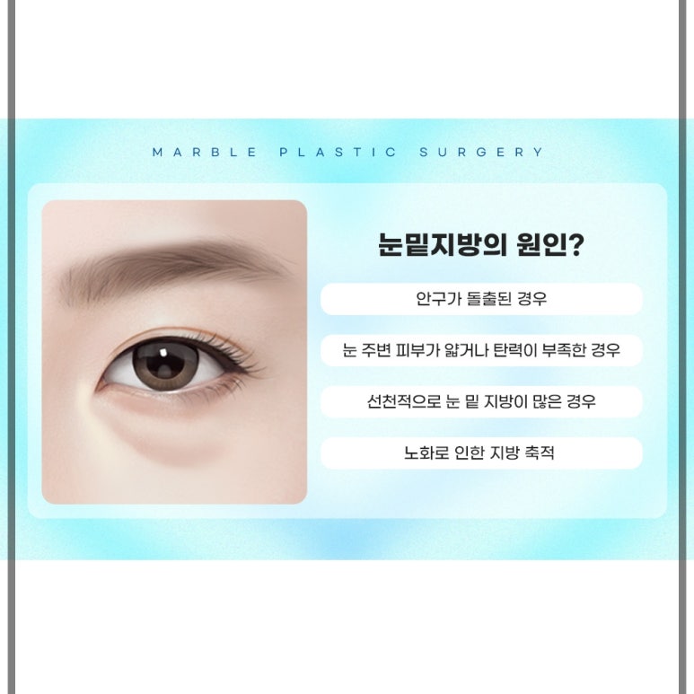 눈밑지방재배치와 다크서클 완화, 두 마리 토끼를 잡다 관련 이미지 5