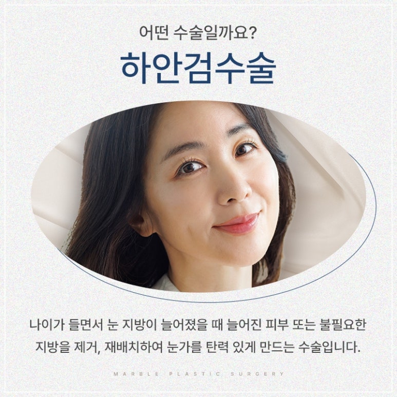 Differences in Lower Eyelid Surgery by Age Group and Recommended Methods: Showing Your Parents Appreciation Through Lower Eyelid Surgery (Before-and-After Photos O) @ Marble Plastic Surgery Clinic image 2