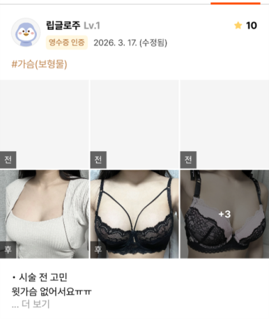 [가슴확대수술 잘하는 곳 마블성형외과 후기] 윗가슴이 없어서 나시 입을 때마다 텅 비어 보이던 과거..ㅠㅠ 관련 이미지 1